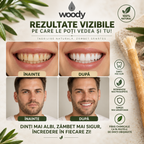 Miswak natural din lemn de Arak Woody – imagine 4